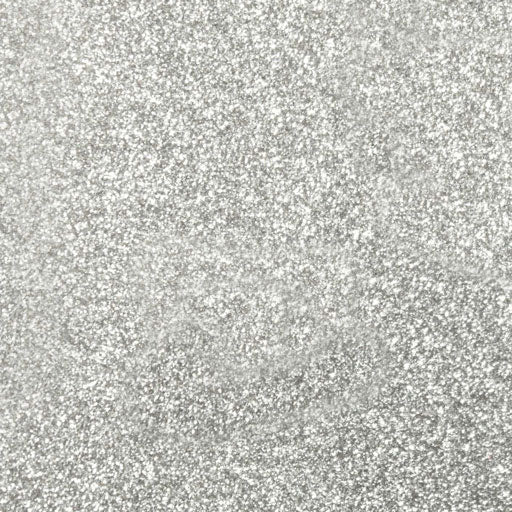 12 x 20 Siser Glitter HTV – MyVinylCircle